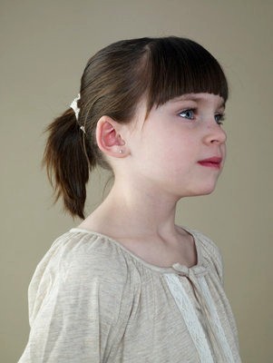 儿童患了白癜风该怎么办