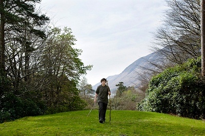 寻常型白癜风症状是什么样的?