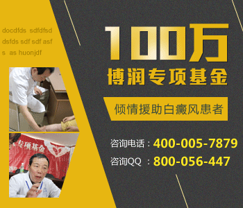 导致白癜风的出现的原因是什么