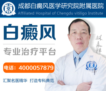 白癜风是有哪些原因引起的