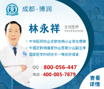 白癜风引发的原因有哪些