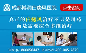 出现白癜风的原因