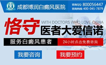 白癜风的发病原因具体有哪些