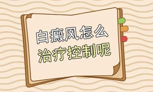成都有没有看白斑医院?如何诊断儿童白癜风